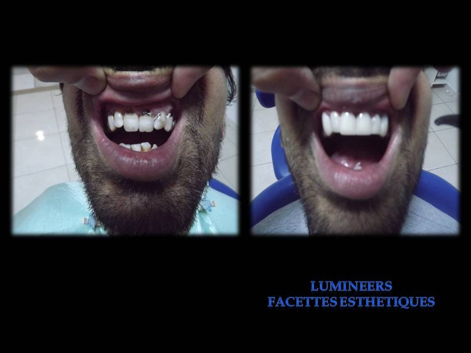 مركز الابتسامة - SMILE CENTRE