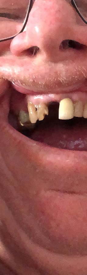 Smile Dental - Smile Dental