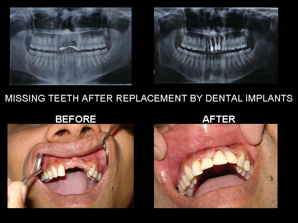 Smile Ray Super-Specialty Dental Clinic, kanpur - Smile Ray Super-Specialty Dental Clinic, kanpur