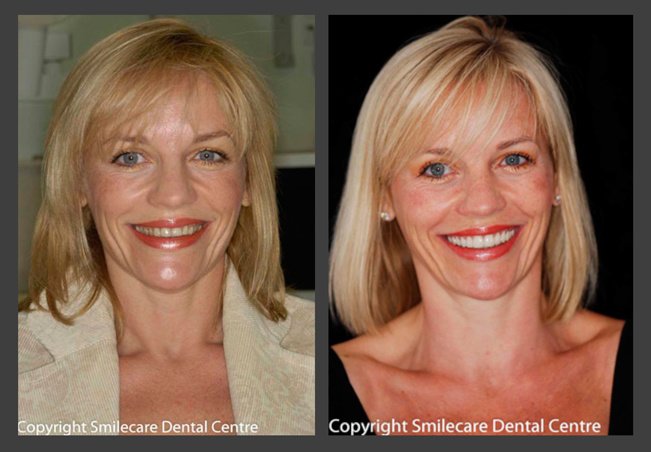 Smilecare Dental Centre - Smilecare Dental Centre