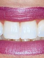 Smiles and More - Widnes - Smiles and More - Widnes