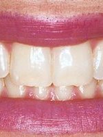 Smiles and More - Widnes - Smiles and More - Widnes