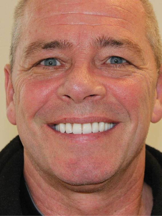 Smiles and More - Widnes - Smiles and More - Widnes