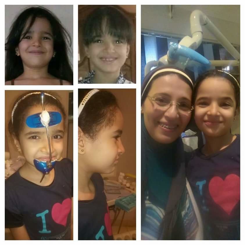 ابتسامات تقويم الأسنان - Smiles Orthodontics