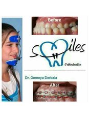 ابتسامات تقويم الأسنان - Smiles Orthodontics
