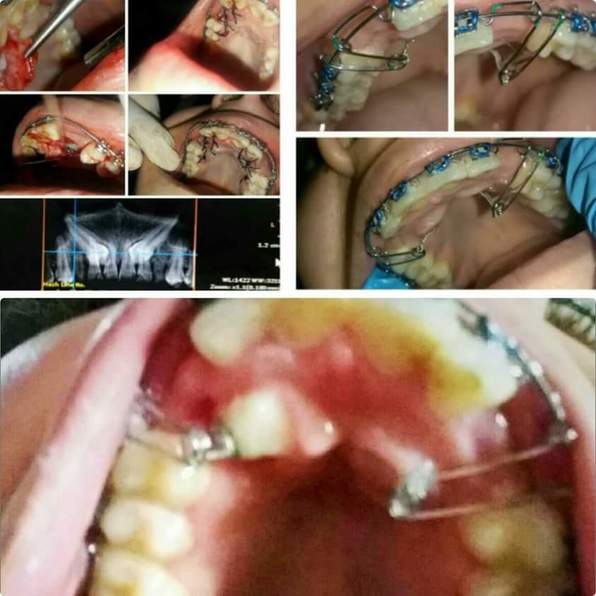 ابتسامات تقويم الأسنان - Smiles Orthodontics