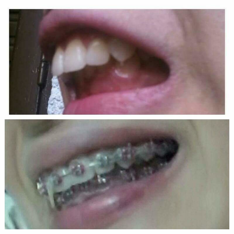 ابتسامات تقويم الأسنان - Smiles Orthodontics