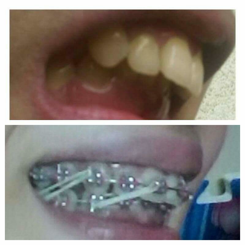 ابتسامات تقويم الأسنان - Smiles Orthodontics