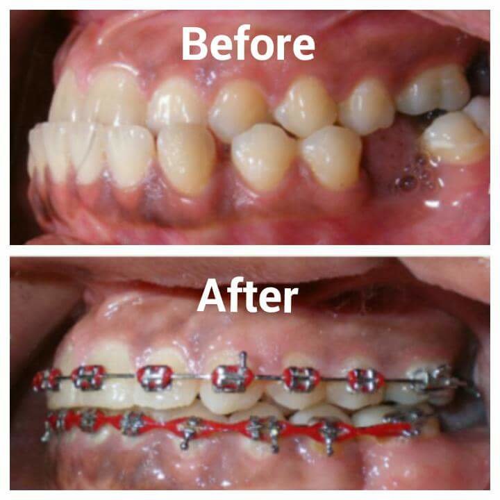 ابتسامات تقويم الأسنان - Smiles Orthodontics