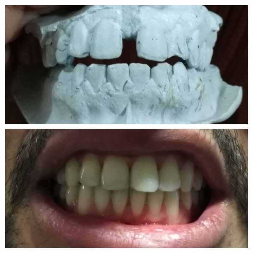 ابتسامات تقويم الأسنان - Smiles Orthodontics