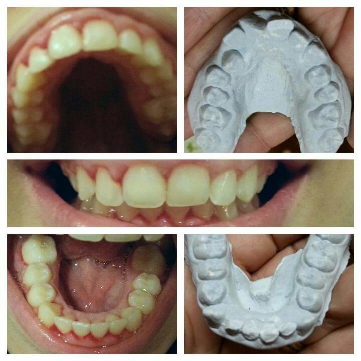ابتسامات تقويم الأسنان - Smiles Orthodontics