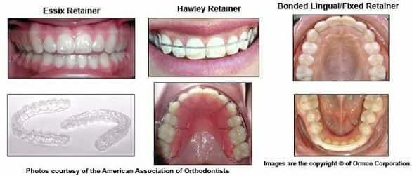 ابتسامات تقويم الأسنان - Smiles Orthodontics