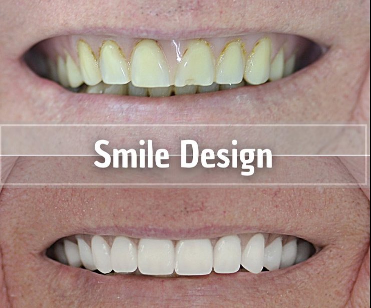 Smiles Peru - Smiles Peru