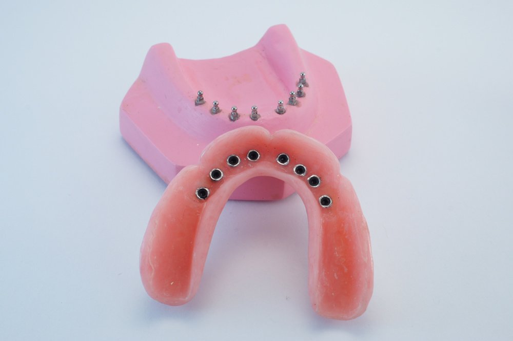Snap In Dentures - Snap In Dentures