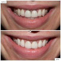 SOK HANN DENTAL CLINIC - SOK HANN DENTAL CLINIC