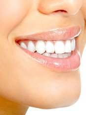 Sparkle Cosmetic Teeth Whitening - Sparkle Cosmetic Teeth Whitening