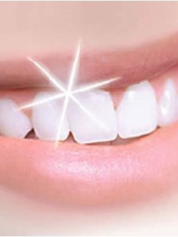 Sparkles Clinics Teeth Whitening - Sparkles Clinics Teeth Whitening