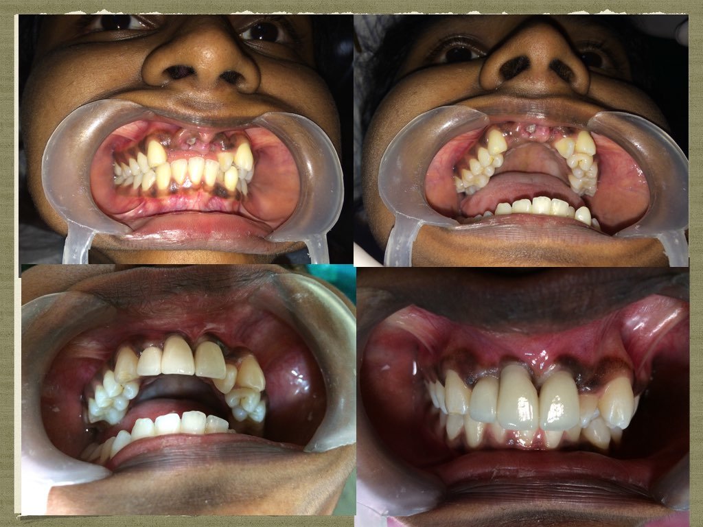 Sparks Cosmetic & Dental Surgery - Sparks Cosmetic & Dental Surgery