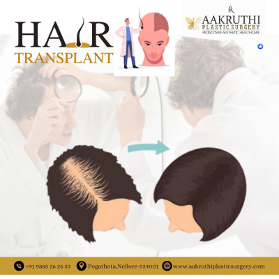 sr.AAKRUTHI Plastic Surgery - sr.AAKRUTHI Plastic Surgery