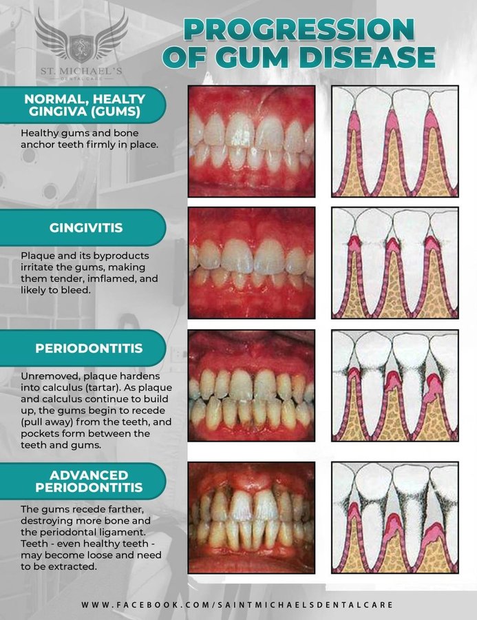 St. Michael's Dental Care - St. Michael's Dental Care