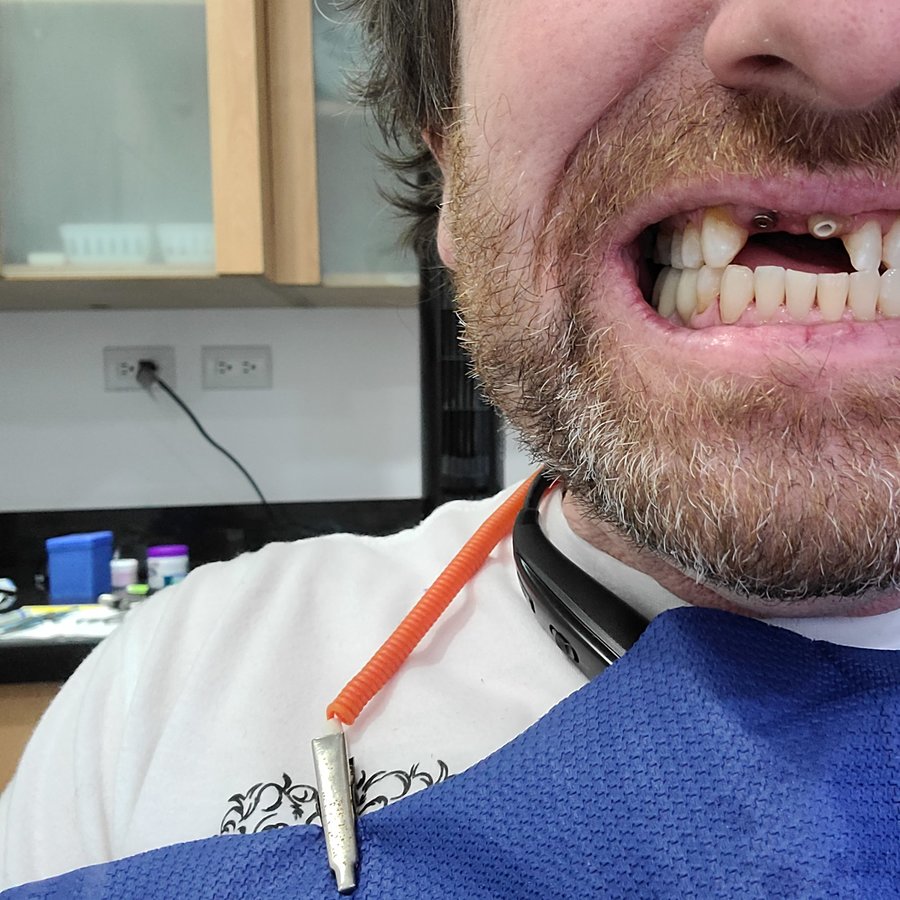 Star Dental Implant Center - Star Dental Implant Center