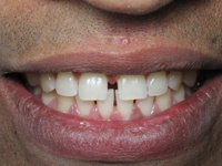 StarBrite Dental- Dr. Munira Lokhandwala - StarBrite Dental- Dr. Munira Lokhandwala