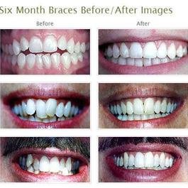 StarBrite Dental- Dr. Munira Lokhandwala - StarBrite Dental- Dr. Munira Lokhandwala