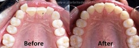 StarBrite Dental- Dr. Munira Lokhandwala - StarBrite Dental- Dr. Munira Lokhandwala
