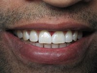 StarBrite Dental- Dr. Munira Lokhandwala - StarBrite Dental- Dr. Munira Lokhandwala