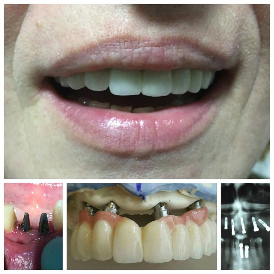 ستوماتولوكا Ordinacija الدكتور كامينيكا - Stomatološka Ordinacija Dr Kamenica