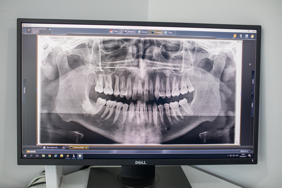 ستوماتولوكا Ordinacija الدكتور كامينيكا - Stomatološka Ordinacija Dr Kamenica