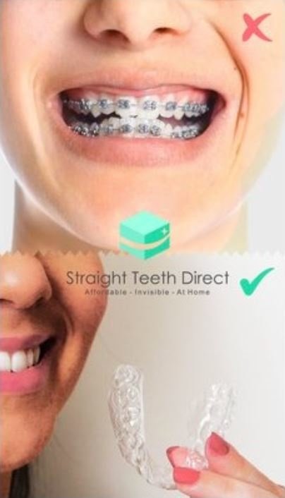Straight Teeth Direct -Barcelona - Straight Teeth Direct -Barcelona