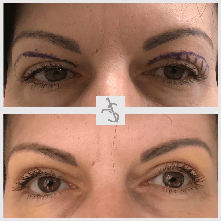 Strevinas Plastic Surgery - Strevinas Plastic Surgery