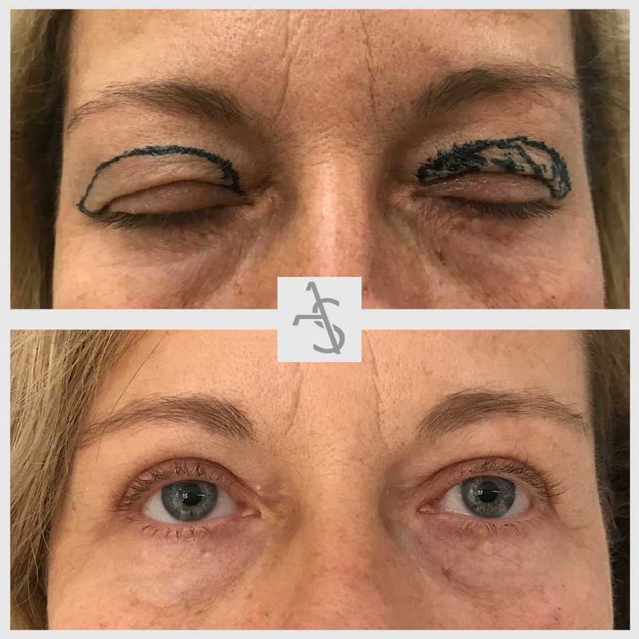 Strevinas Plastic Surgery - Strevinas Plastic Surgery