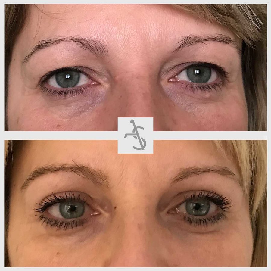 Strevinas Plastic Surgery - Strevinas Plastic Surgery