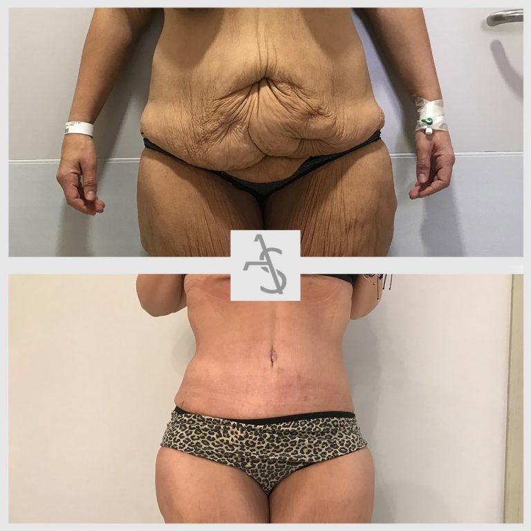 Strevinas Plastic Surgery - Strevinas Plastic Surgery