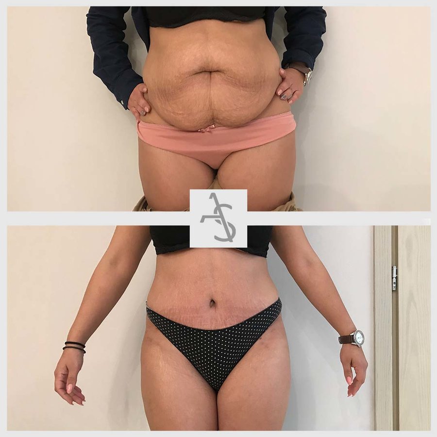 Strevinas Plastic Surgery - Strevinas Plastic Surgery