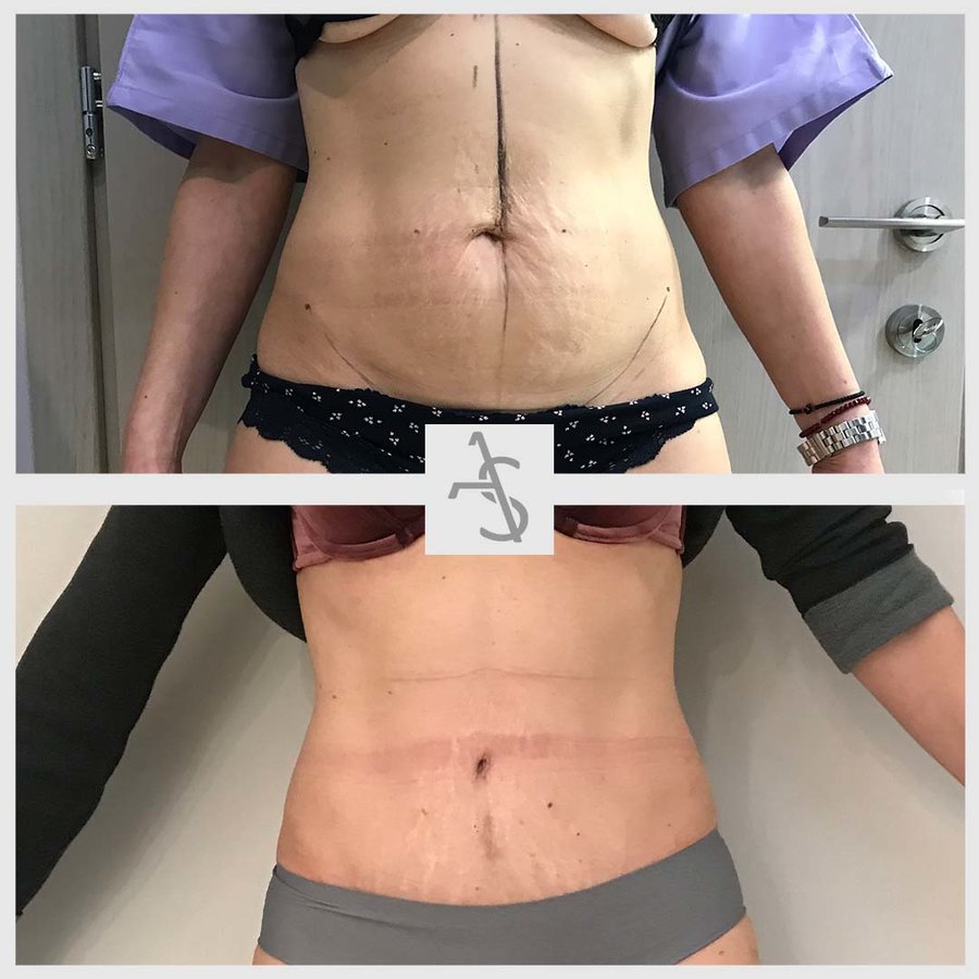 Strevinas Plastic Surgery - Strevinas Plastic Surgery