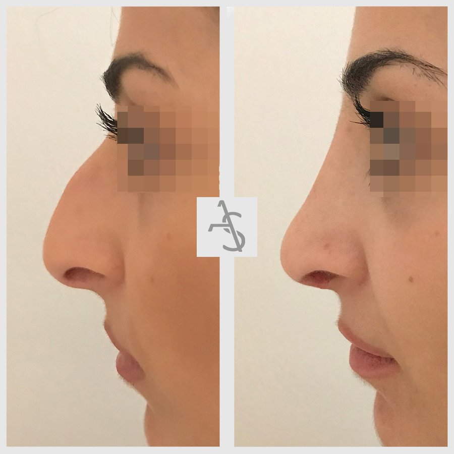 Strevinas Plastic Surgery - Strevinas Plastic Surgery