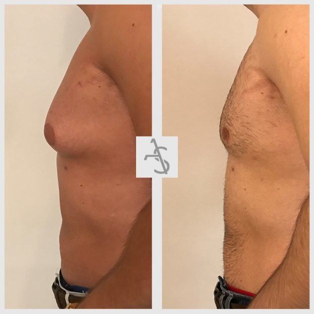 Strevinas Plastic Surgery - Strevinas Plastic Surgery