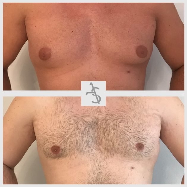 Strevinas Plastic Surgery - Strevinas Plastic Surgery