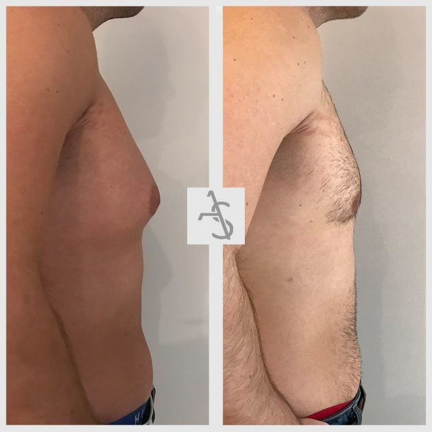 Strevinas Plastic Surgery - Strevinas Plastic Surgery