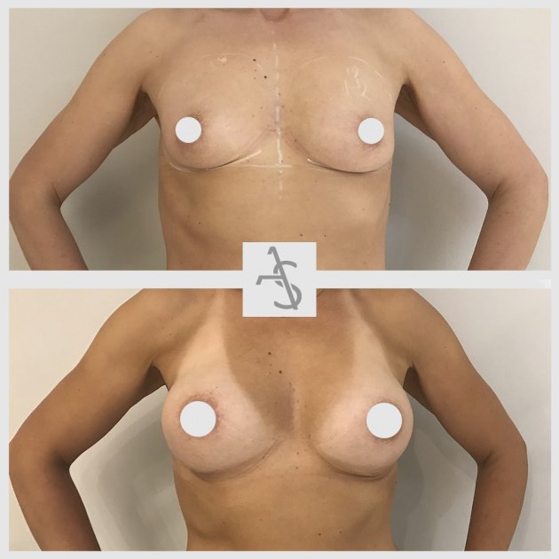 Strevinas Plastic Surgery - Strevinas Plastic Surgery