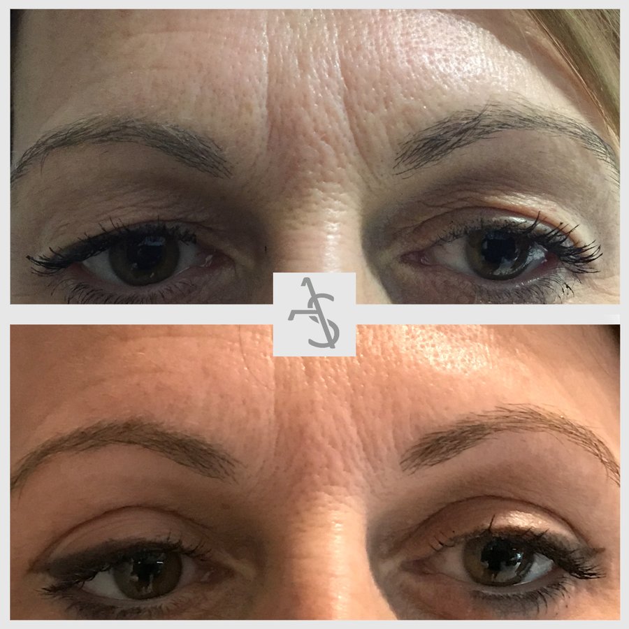 Strevinas Plastic Surgery - Strevinas Plastic Surgery