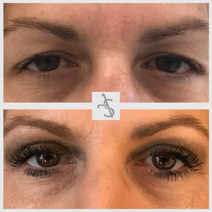 Strevinas Plastic Surgery - Strevinas Plastic Surgery