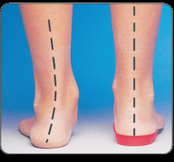 Stride Fitness and Mobility Clinic - Stride Fitness and Mobility Clinic