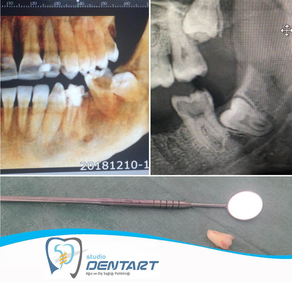 Studio Dentart - Studio Dentart