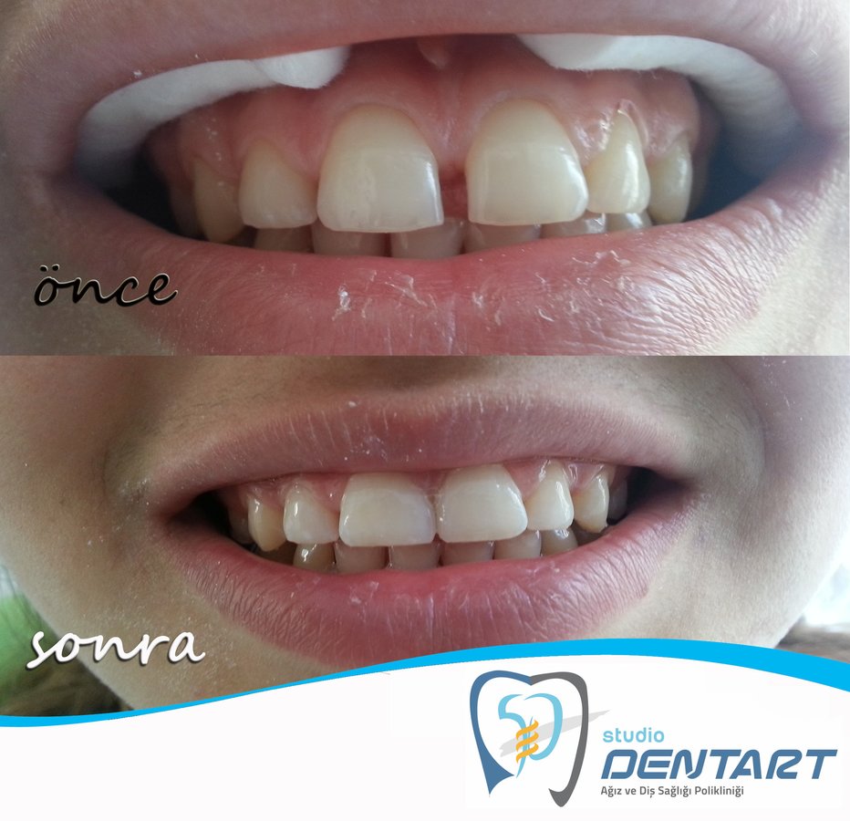 Studio Dentart - Studio Dentart