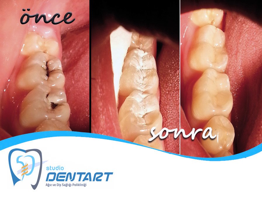 Studio Dentart - Studio Dentart