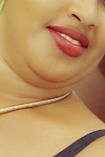 Success Skin Solution - Success Skin Solution